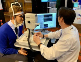 Heidelberg OCT imaging